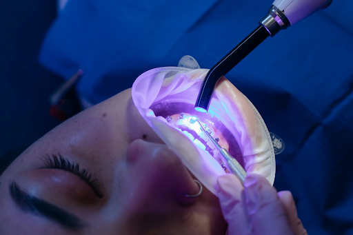 Braces or Invisalign
